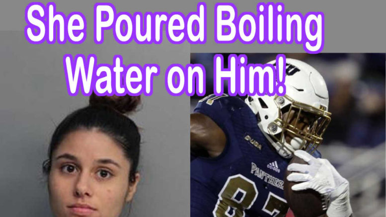 FIU Player Burned by Boiling Water from Girlfriend